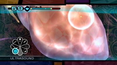 Trauma Team - Screenshot - Gameplay (null) - 1920x1080