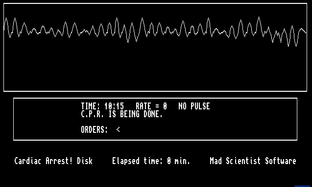 Cardiac Arrest