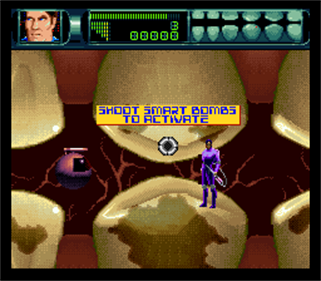 Rex Ronan: Experimental Surgeon - Screenshot - Gameplay Image