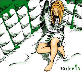 Varicella - Box - Front Image
